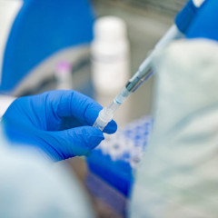 ANS aprova proposta de inclusão no Rol de novos testes para Covid-19 em razão de decisão judicial