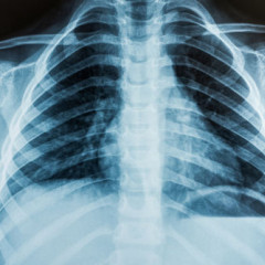 Proibição da exigência de raio x e fotografias para comprovação da realização de procedimentos Odontológicos